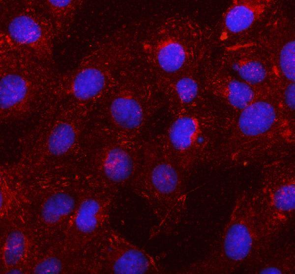  IF analysis of SSH1 using anti-SSH1 antibody (A03480)