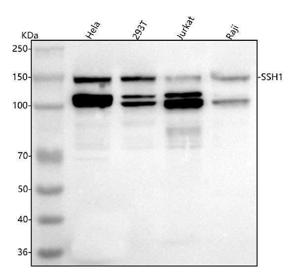  Western blot analysis of SSH1 using anti-SSH1 antibody (A03480)