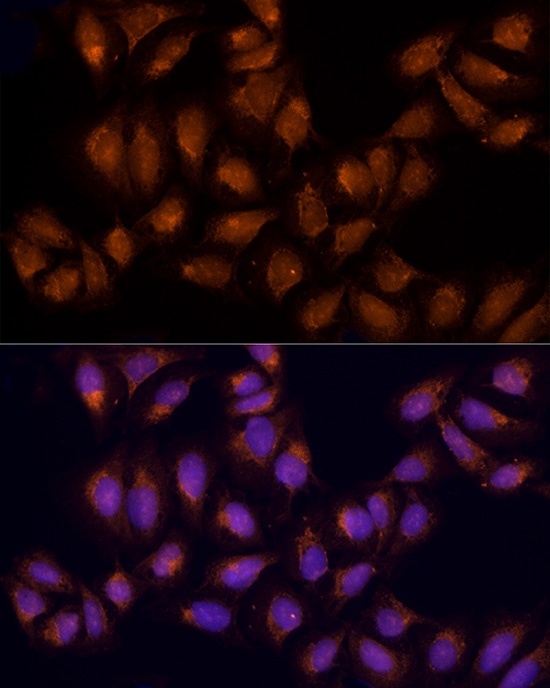 Immunofluorescence analysis of U2OS using AGPS antibody  at dilution of 1:100 