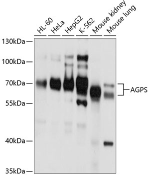 Western blot analysis of extracts of various cell lines, using AGPS antibody  at 1:1000 dilution