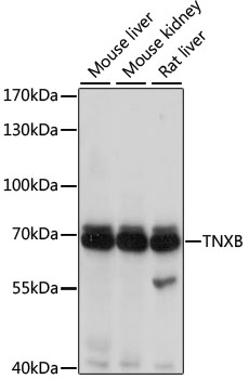Western blot analysis of extracts of various cell lines, using TNXB antibody  at 1:1000 dilution