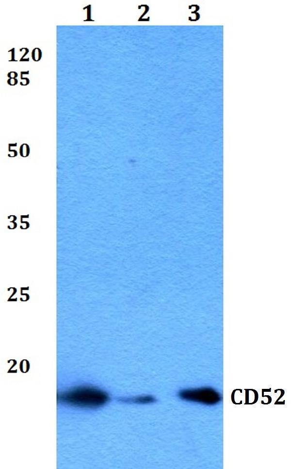 a03484 cd52 primary antiboties wb testing 1