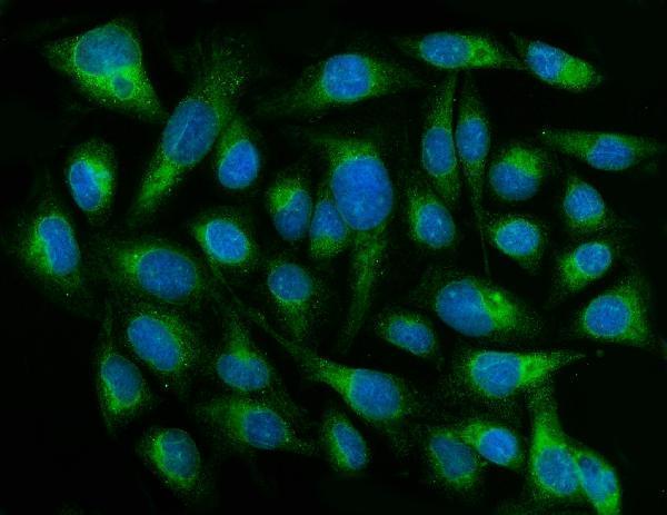  IF analysis of CYB5R3 using anti-CYB5R3 antibody (A03487-4)