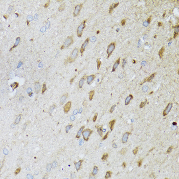 a03488 1 mt nd5 primary antiboties ihc testing 2