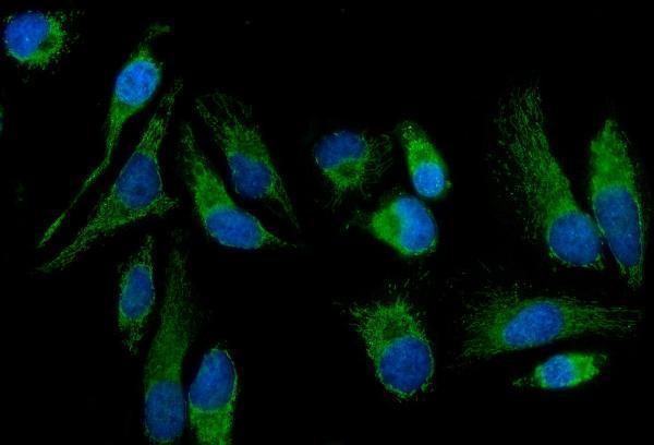 a03488 2 mtnd5 primary antibodies if testing 9