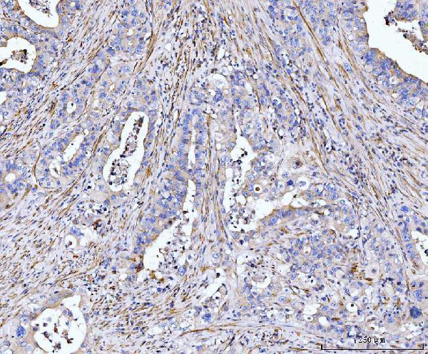  IHC analysis of MT-ND5 using anti-MT-ND5 antibody (A03488-2)