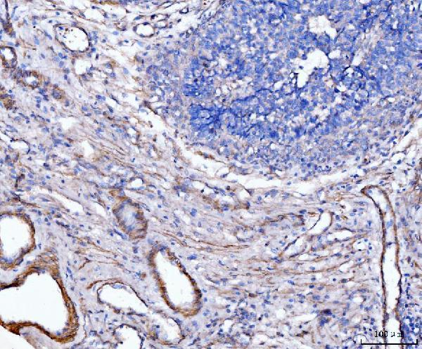  IHC analysis of MT-ND5 using anti-MT-ND5 antibody (A03488-2)