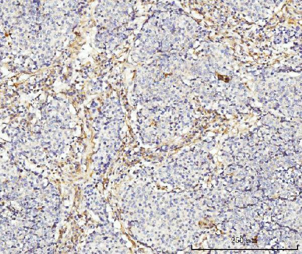 a03488 2 mtnd5 primary antibodies ihc testing 5