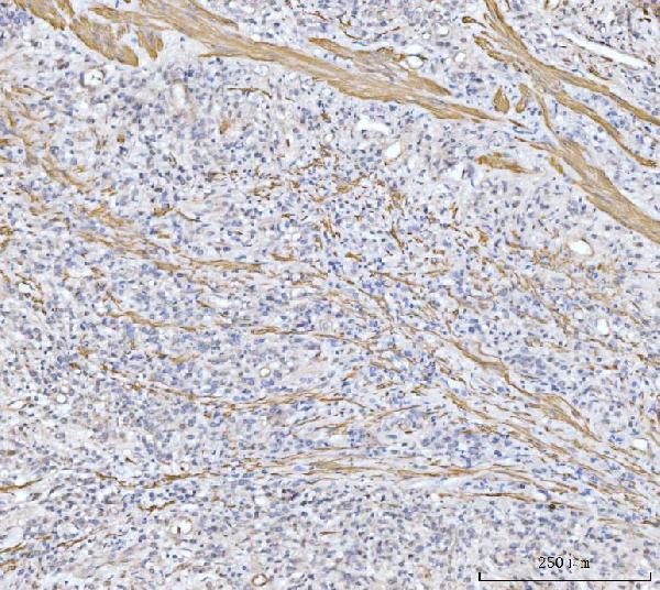 a03488 2 mtnd5 primary antibodies ihc testing 6