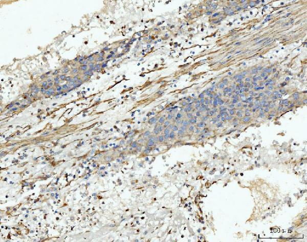 a03488 2 mtnd5 primary antibodies ihc testing 7