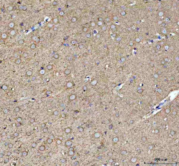  IHC analysis of POMGNT1 using anti-POMGNT1 antibody (A03489-1)