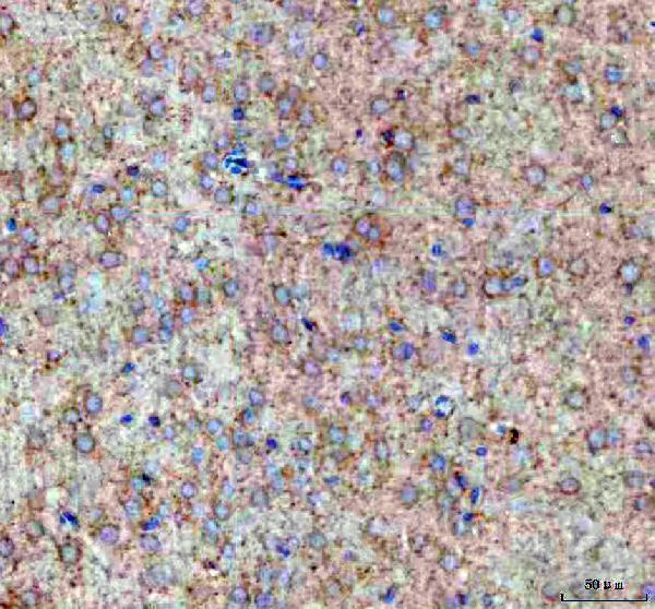 a03489 1 pomgnt1 primary antibodies ihc testing 3