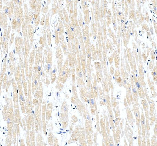 IHC analysis of POMGNT1 using anti-POMGNT1 antibody (A03489-1)