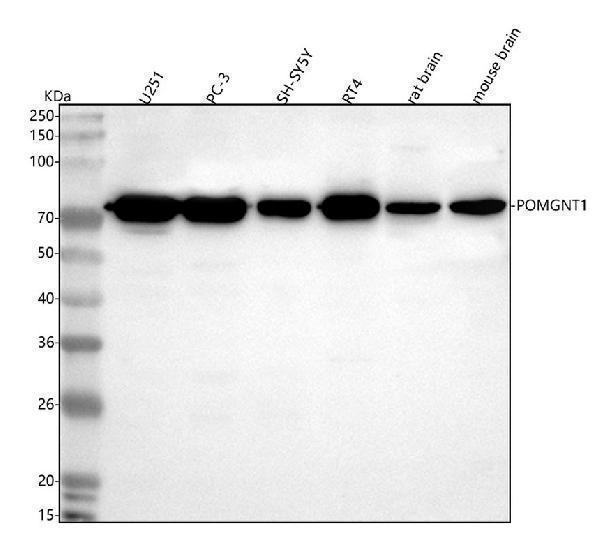 Western blot analysis of POMGNT1 using anti-POMGNT1 antibody (A03489-1)