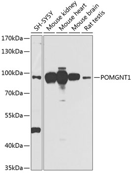 a03489 pomgnt1 primary antiboties wb testing 1