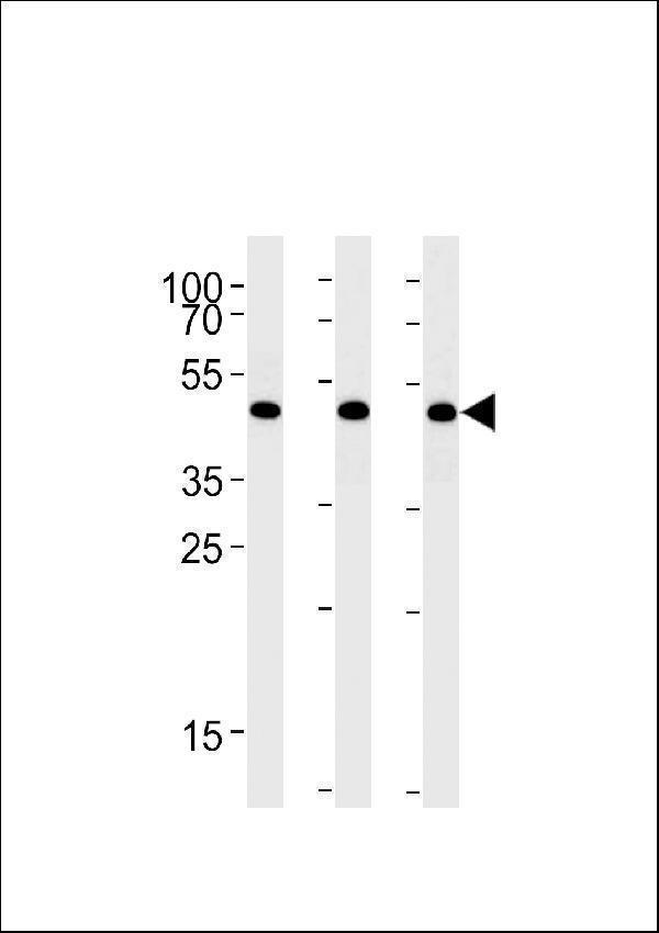 BAT1 Antibody (C-term) western blot analysis in A431,Hela,Jurkat cell line lysates (35ug/lane)