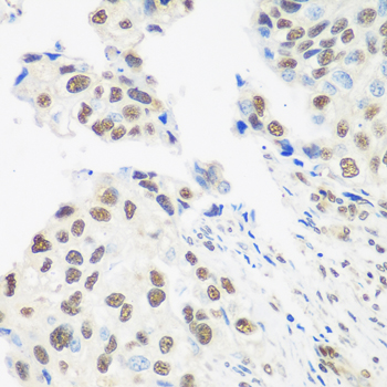 a03490 ddx39b primary antiboties ihc testing 2