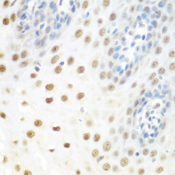 a03490 ddx39b primary antiboties ihc testing 3
