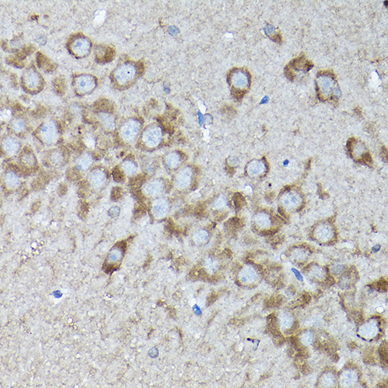 a03491 snapin primary antiboties ihc testing 2