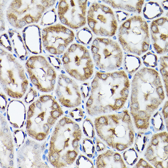 a03491 snapin primary antiboties ihc testing 3