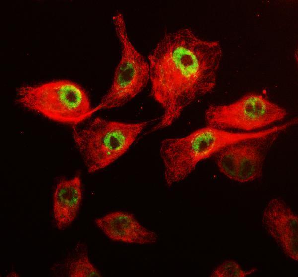 a03495 1 cdk12 primary antibodies if testing 5