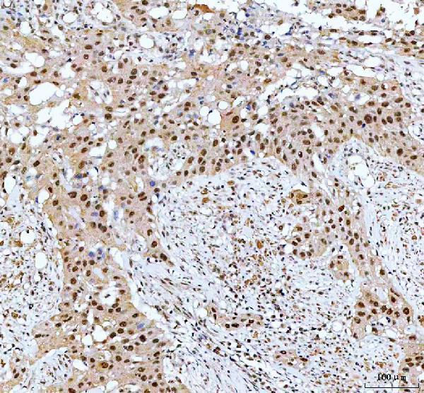 a03495 1 cdk12 primary antibodies ihc testing 2