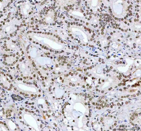 a03495 1 cdk12 primary antibodies ihc testing 3
