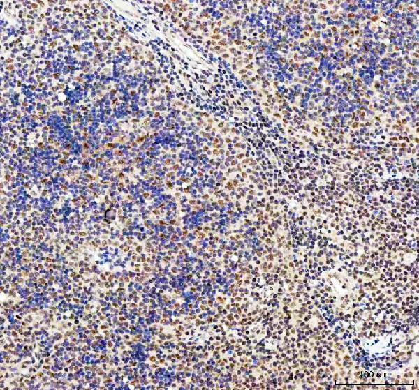 a03495 1 cdk12 primary antibodies ihc testing 4