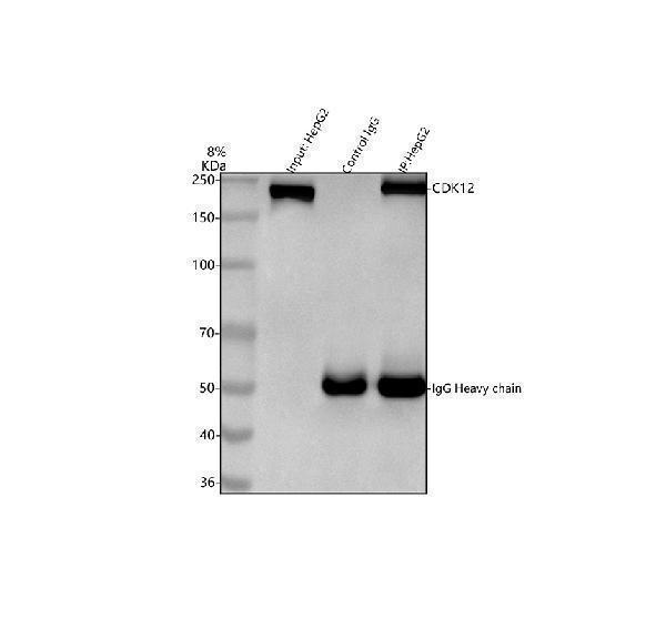 a03495 1 cdk12 primary antibodies ip testing 7