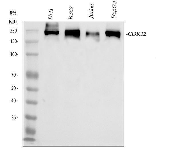a03495 1 cdk12 primary antibodies wb testing 1