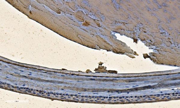 a03496 2 cryab primary antibodies ihc testing 11