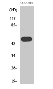 Western blotting validation for Anti-Histamine H1 Receptor HRH1 Antibody A03497-1
Western Blot (WB) analysis of specific cells using Histamine H1 Receptor polyclonal antibody
