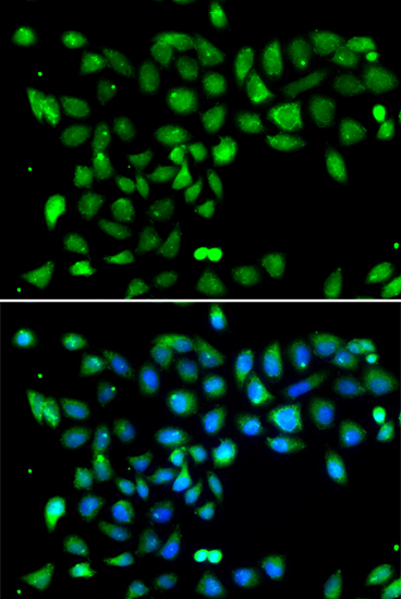 Immunofluorescence analysis of U20S cell using DYRK2 antibody