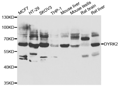Western blot analysis of extracts of various cell lines, using DYRK2 antibody