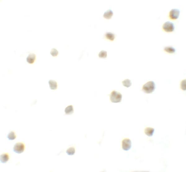 Immunocytochemistry of DYRK2 in 293 cells with DYRK2 antibody at 10 μg/mL
