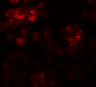 Immunofluorescence of DYRK2 in 293 cells with DYRK2 antibody at 20 μg/mL
