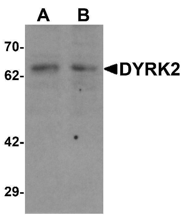 Western blot analysis of DYRK2 in 293 cell lysate with DYRK2 antibody at (A) 1 and (B) 2 μg/mL