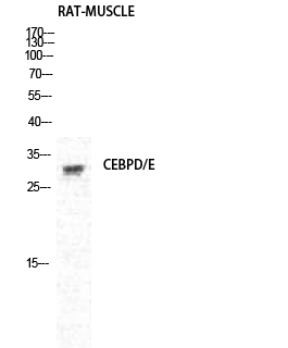 Western blotting validation for Anti-C/EBP delta/epsilon CEBPD Antibody A03499
Western Blot (WB) analysis of Rat Muscle cells using C/EBP delta/epsilon polyclonal antibody