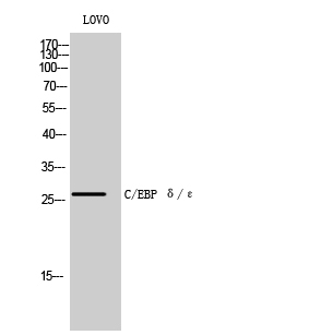 Western blotting validation for Anti-C/EBP delta/epsilon CEBPD Antibody A03499
Western Blot (WB) analysis of LOVO cells using C/EBP delta/epsilon polyclonal antibody