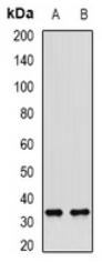 Western blot analysis of SULT1A1 expression in mouse liver (A), rat liver (B) whole cell lysates