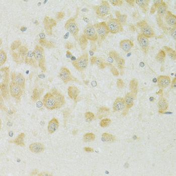 Immunohistochemistry of paraffin-embedded rat brain using SLC37A4 antibody  at dilution of 1:100 