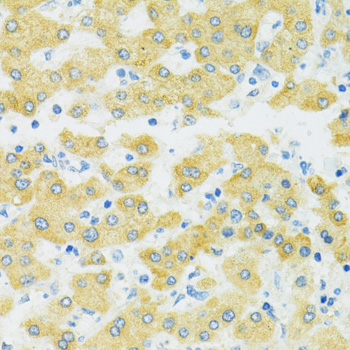 Immunohistochemistry of paraffin-embedded human liver using SLC37A4 antibody  at dilution of 1:100 