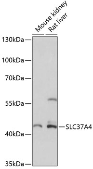 Western blot analysis of extracts of various cell lines, using SLC37A4 antibody  at 1:3000 dilution