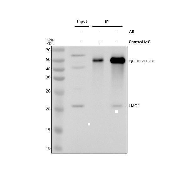 Immunoprecipitating (IP) LMO2 in K562 whole cell lysate