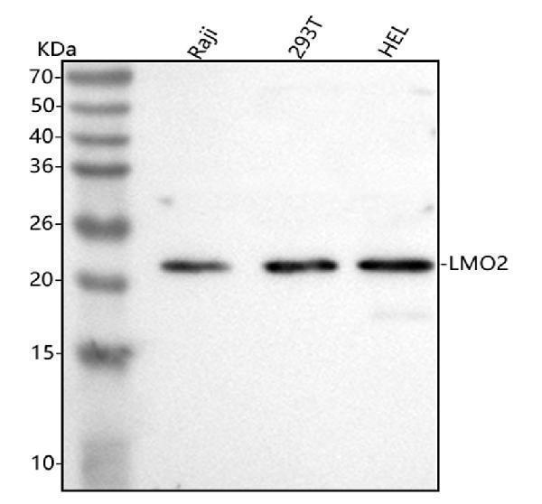  Western blot analysis of LMO2 using anti-LMO2 antibody (A03502-2)