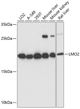 Western blot analysis of extracts of various cell lines, using LMO2 antibody  at 1:3000 dilution