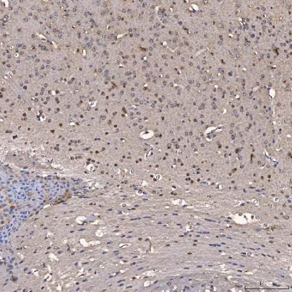 a03504 1 nob1 primary antibodies ihc testing 2