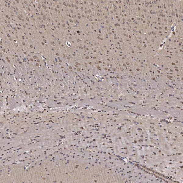 a03504 1 nob1 primary antibodies ihc testing 3