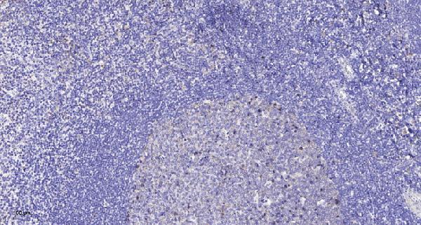 a03510 ptprz1 primary antibodies ihc testing 1