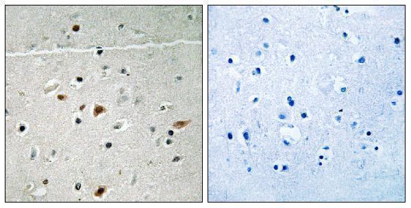 a03511s283 limk2 primary antibodies ihc testing 3